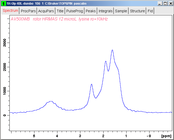1H L-lysine windowed dumbo spectrum